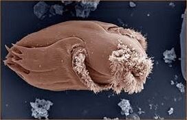 Microorganismos patógenos en humanos