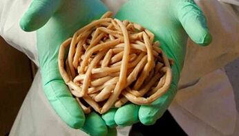 Métodos de eliminación de parásitos del cuerpo
