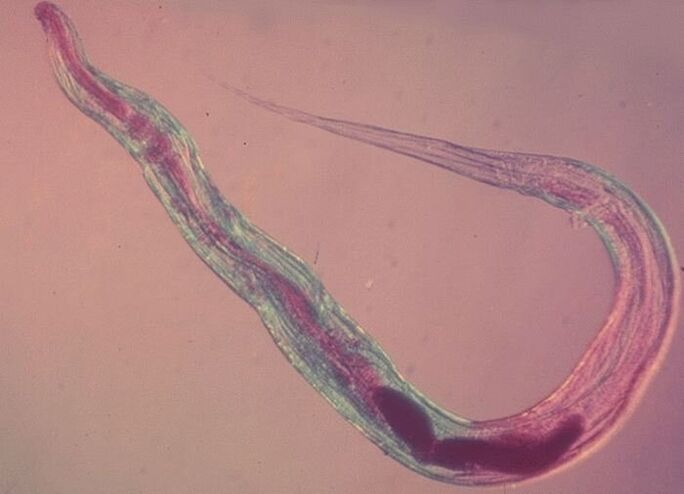 Oxiuros bajo un microscopio