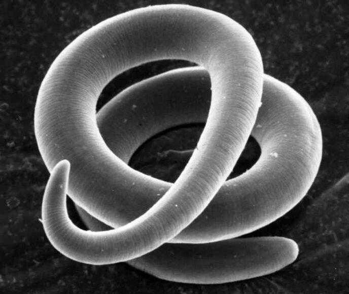 Trichinella bajo un microscopio